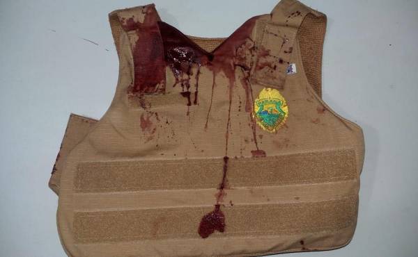 Policial militar leva facada no rosto ao tentar evitar suicídio