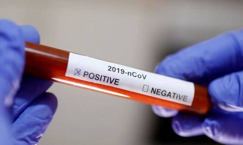 Secretaria Municipal de Saúde de Crissiumal confirma primeiro caso positivo de coronavírus