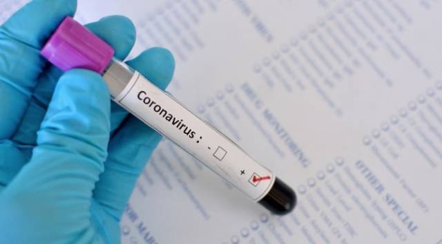 Secretaria da Saúde confirma mais 13 casos de Covid-19 em Três de Maio