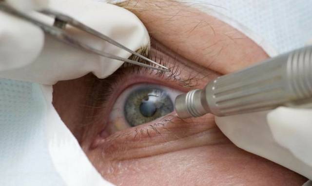 Consultas regulares ao médico oftalmologista podem afastar risco de glaucoma