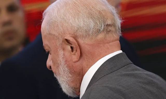 Médico de Lula descarta sequelas e diz que função cerebral está intacta